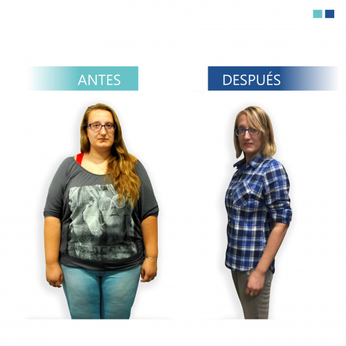 MERITXELL RAMONEDA, PACIENTE CIRUG�A BARI�TRICA BYPASS G�STRICO